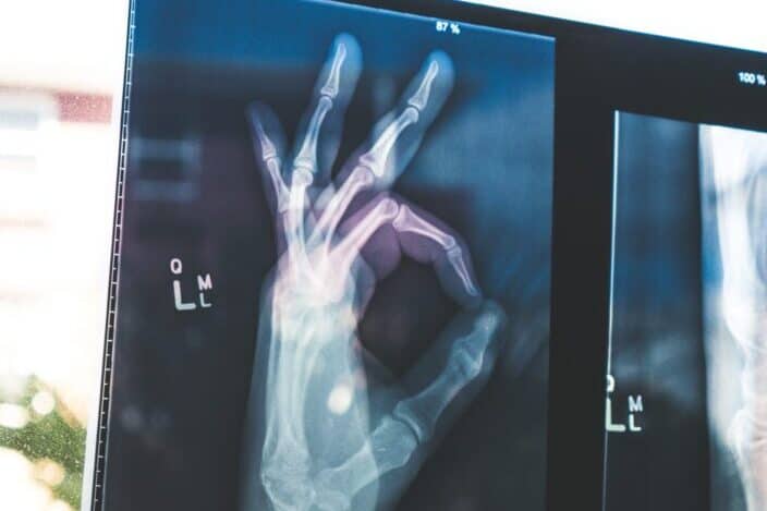 citiscan hand result
